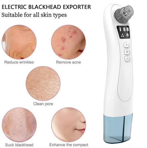 Zenvora™ Blackhead Vacuum Pro